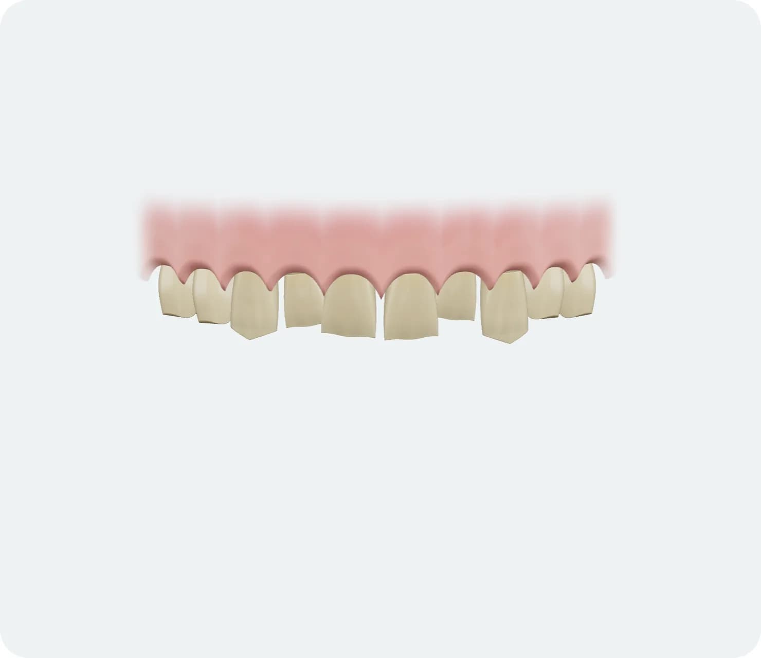 Illustration: Smile Makeover